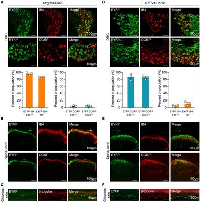 Parallel Spinal Pathways for Transmitting Reflexive and Affective Dimensions of Nocifensive Behaviors Evoked by Selective Activation of the Mas-Related G Protein-Coupled Receptor D-Positive and Transient Receptor Potential Vanilloid 1-Positive Subsets of Nociceptors